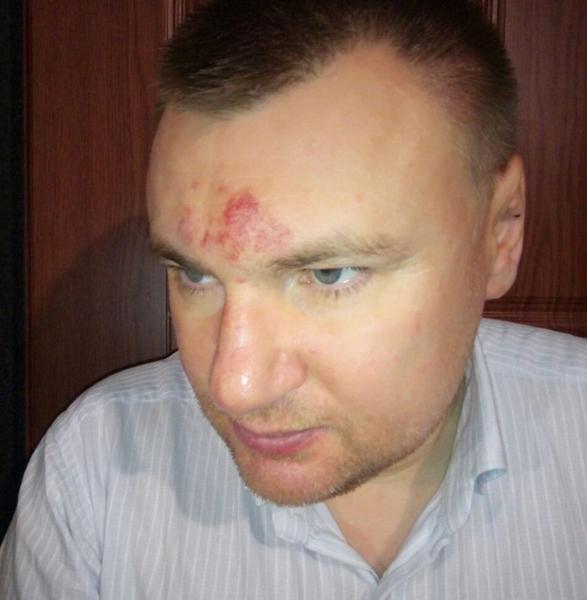 ​В кировском лицее родители избили учительницу и ее адвоката