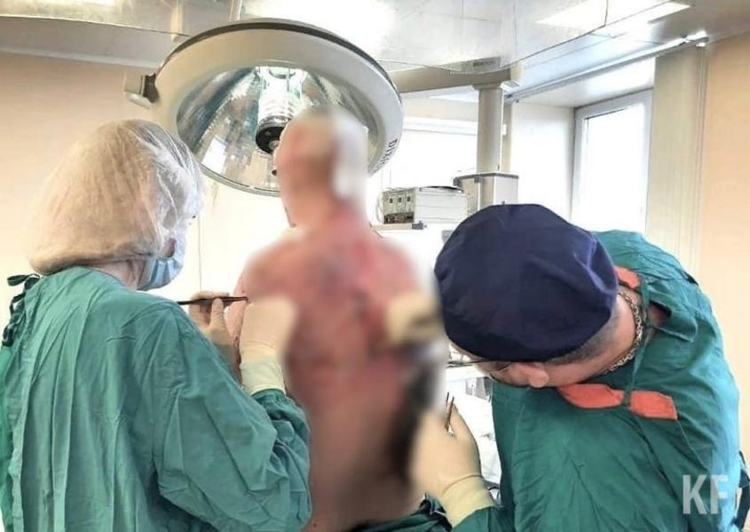 После 8 операций мужчину, у которого было 15% глубоких ожогов, выписали из РКБ Татарстана
