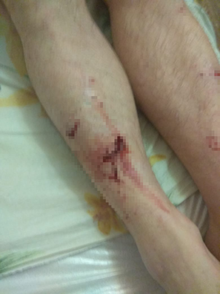 В Татарстане стая бездомных собак чуть не разорвала мужчину