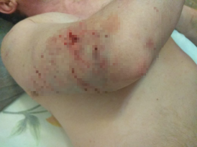 В Татарстане стая бездомных собак чуть не разорвала мужчину