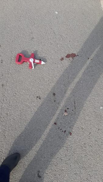 В Нижнекамске на водителя, отправившего ребенка в кому, возбудили уголовное дело В Нижнекамске на водителя, отправившего ребенка в кому, возбудили уголовное дело