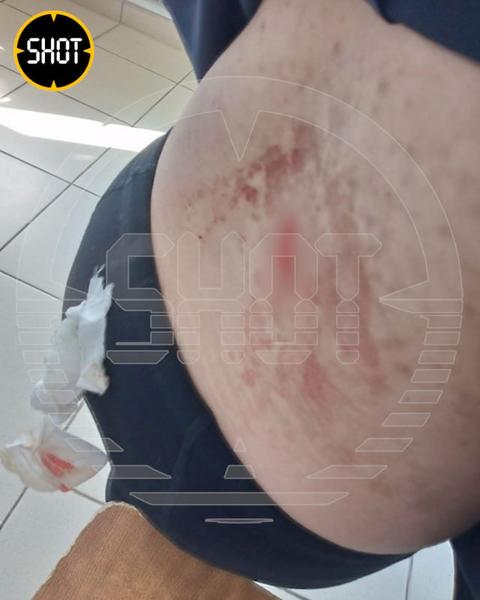 В Башкирии школьница напала на одноклассниц с ножом