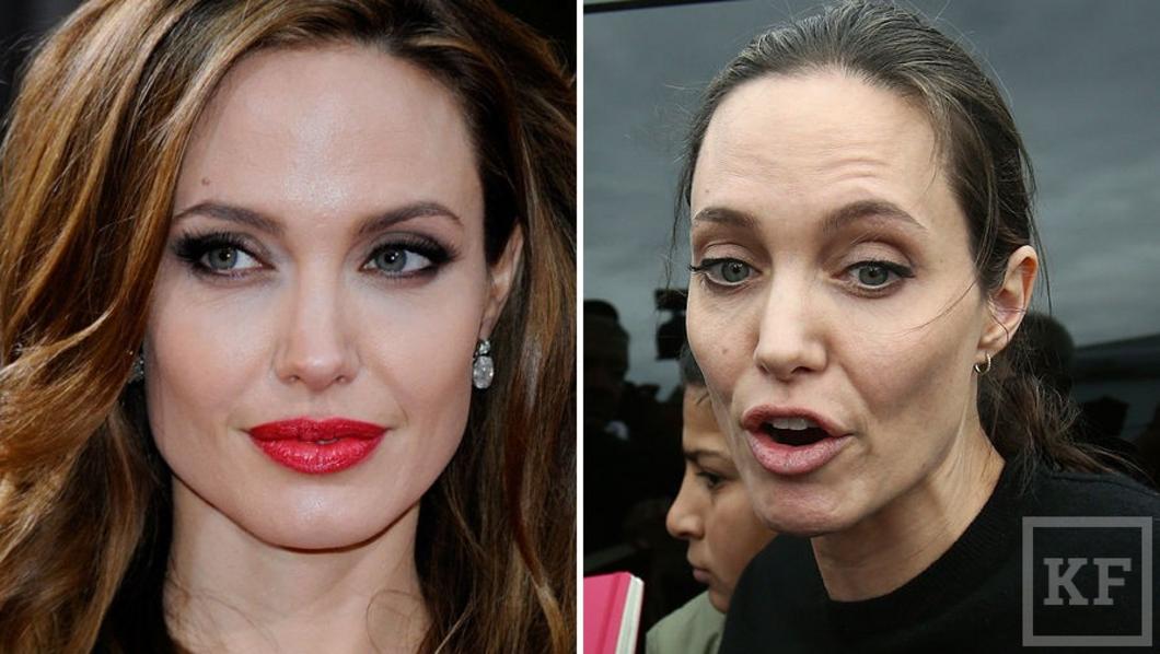 Анджелина Джоли изменилась до неузнаваемости из-за рака