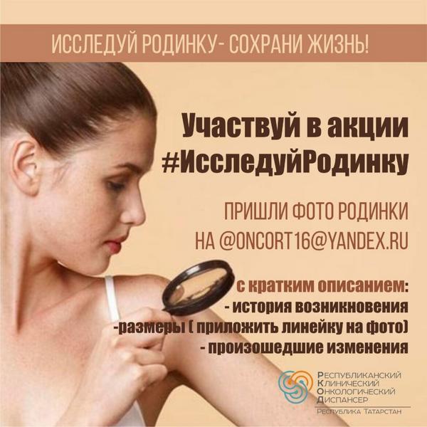 Онкологи Татарстана по фото родинок будут определять рак