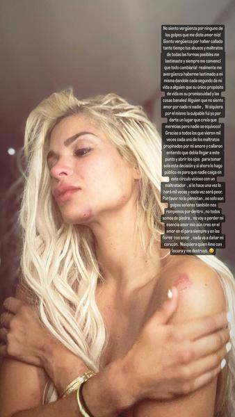 Девушка Кристиана Нобоа обвинила игрока в избиении Девушка Кристиана Нобоа обвинила игрока в избиении