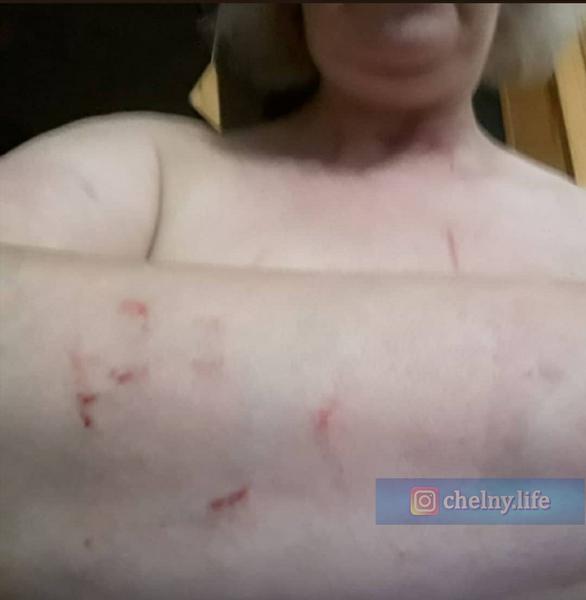 Соцсети: В Челнах «яжемать» оттаскала за волосы пенсионерку из-за сломанного самоката