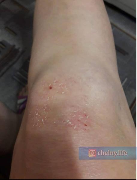 Соцсети: В Челнах «яжемать» оттаскала за волосы пенсионерку из-за сломанного самоката