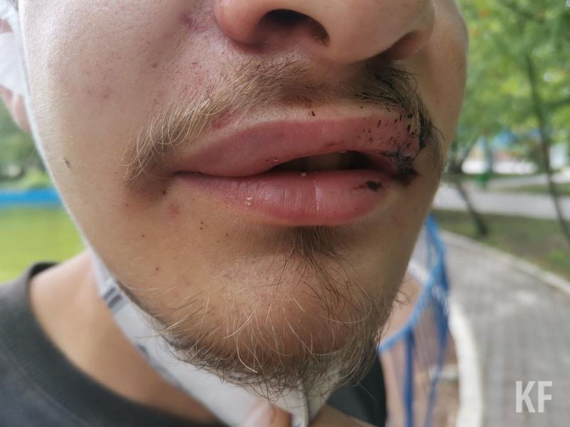 Неизвестные напали на оператора «ТатарстанДа» в Альметьевске