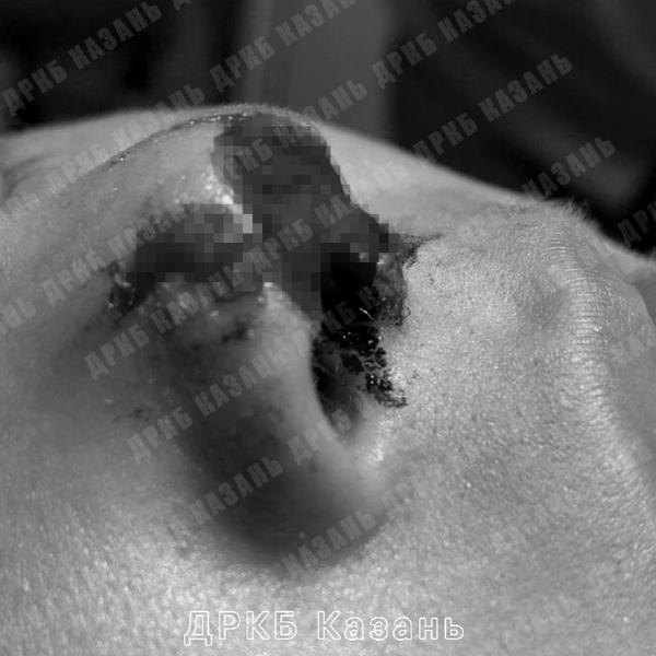 В Казани ребёнок пострадал от нападения собаки В Казани ребёнок пострадал от нападения собаки