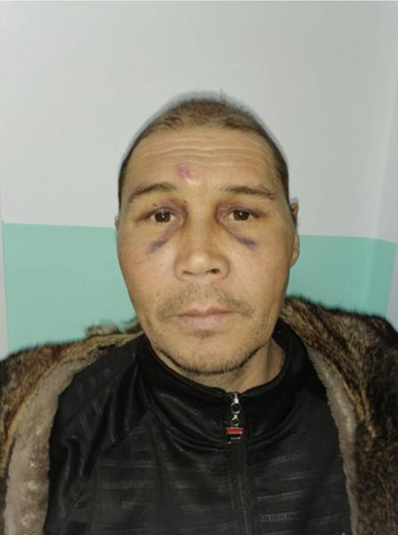 В Приморье пропала 5-летняя девочка после визита друга семьи