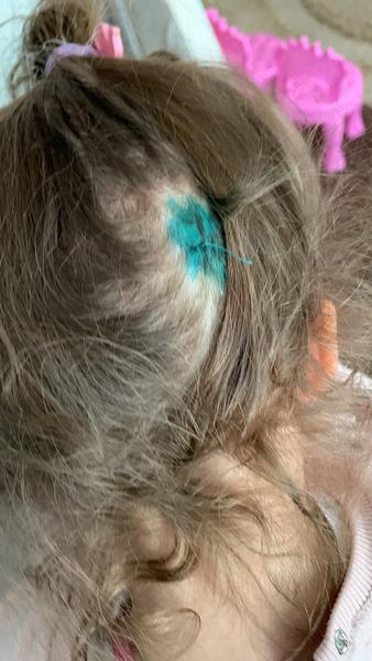 «Окорочок или пельмени из холодильника и кровь остановится»: в Бугульме ранение ребенка в детсаду обернулось увольнением воспитателя и судом «Окорочок или пельмени из холодильника и кровь остановится»: в Бугульме ранение ребенка в детсаду обернулось увольнением воспитателя и судом