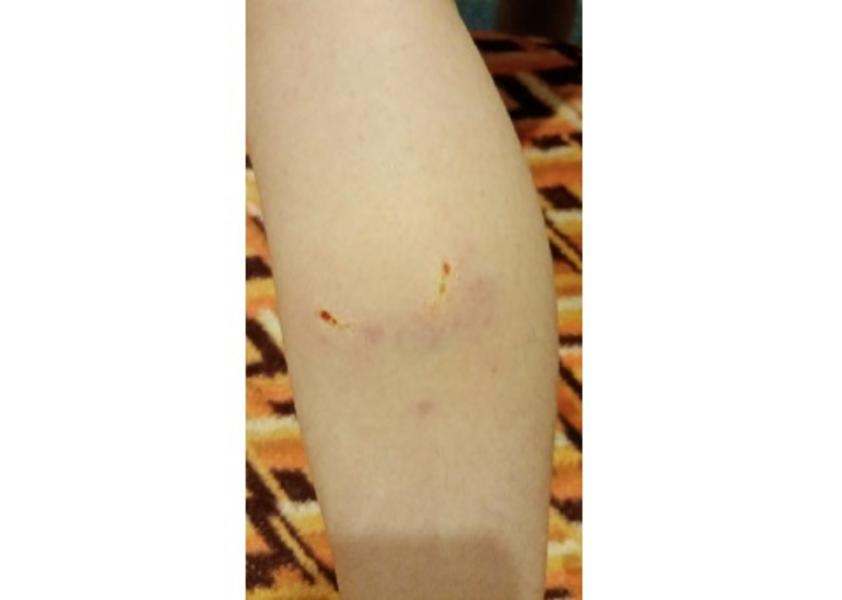 Под Челнами взялись за отлов бездомных собак после жалоб местных жителей