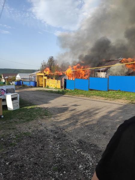 На пожаре в частном доме в Татарстане сильно обгорел мужчина