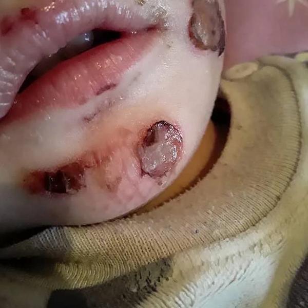 Сломанный нос, ожоги, гематомы и порезы полового органа: изверг-работодатель сядет за издевательство над 2-летним Егором