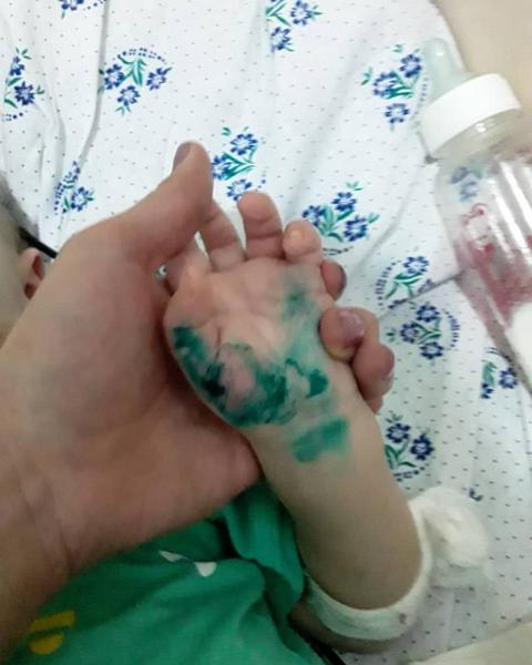 Сломанный нос, ожоги, гематомы и порезы полового органа: изверг-работодатель сядет за издевательство над 2-летним Егором