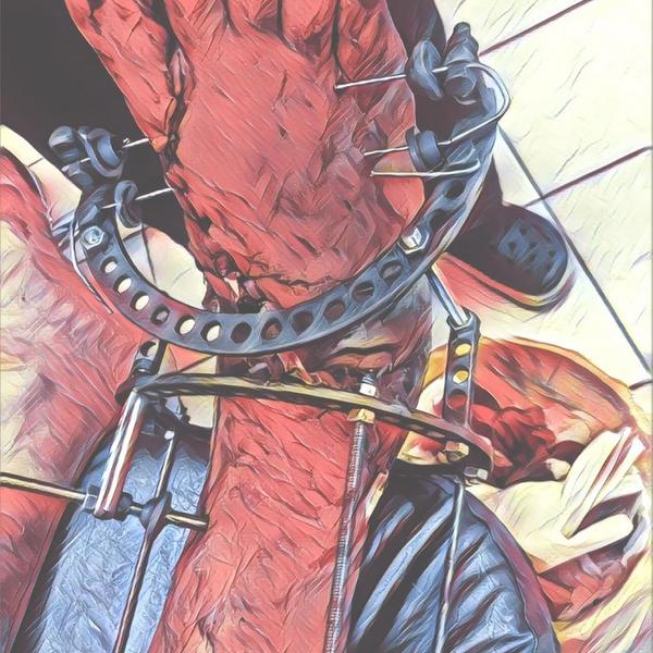 ​Казанские врачи пришили стопу пострадавшему в ДТП с фурой жителю Ульяновска