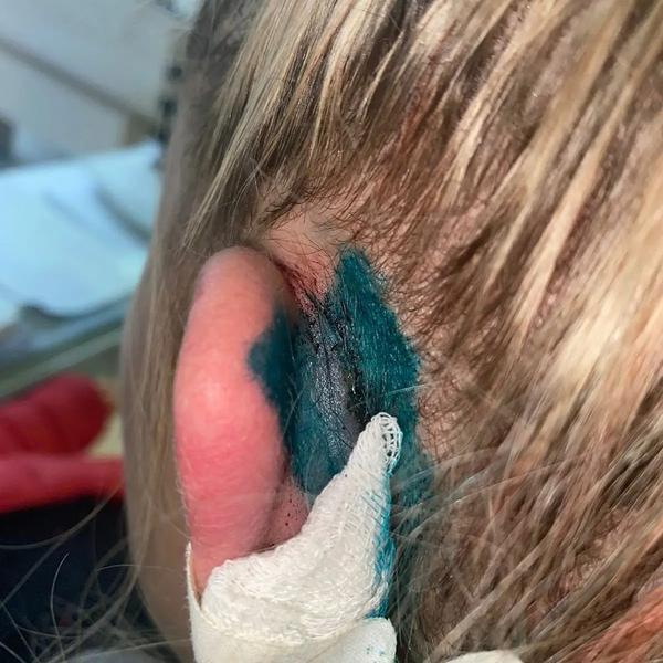 В Нижнекамске незнакомец жестоко избил молодую женщину на глазах у годовалого ребенка