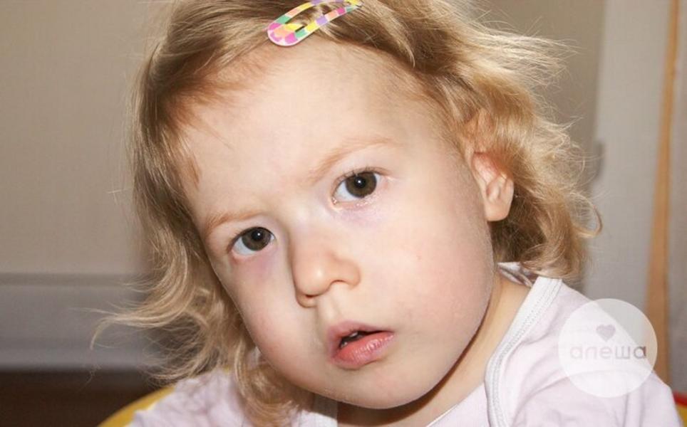 Маленькой жительнице Татарстана с порогом сердца нужна помощь в сборе средств на лечение