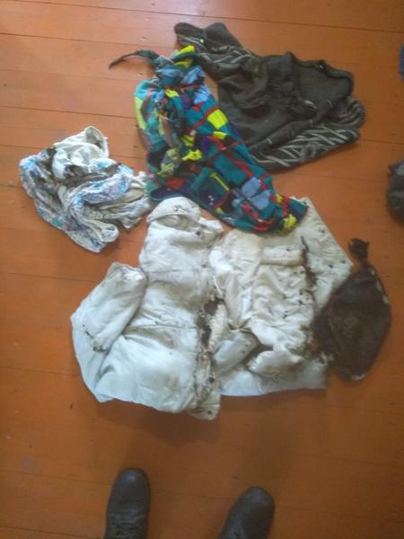 На пожаре в Татарстане 79-летняя пенсионерка получила ожоги лица и рук