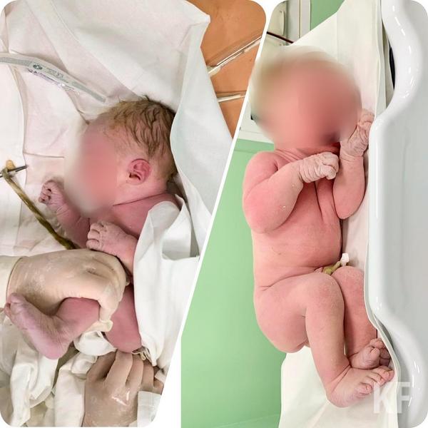 Жительница Казани потеряла сына и винит в этом врачей, медики обвинения отрицают