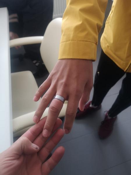 Врач травмпункта Челнов вызвал спасателей, чтобы снять кольцо с пальца ребенка