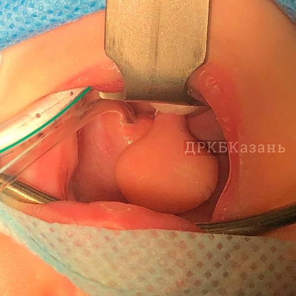 В Казани родился ребенок с двумя языками