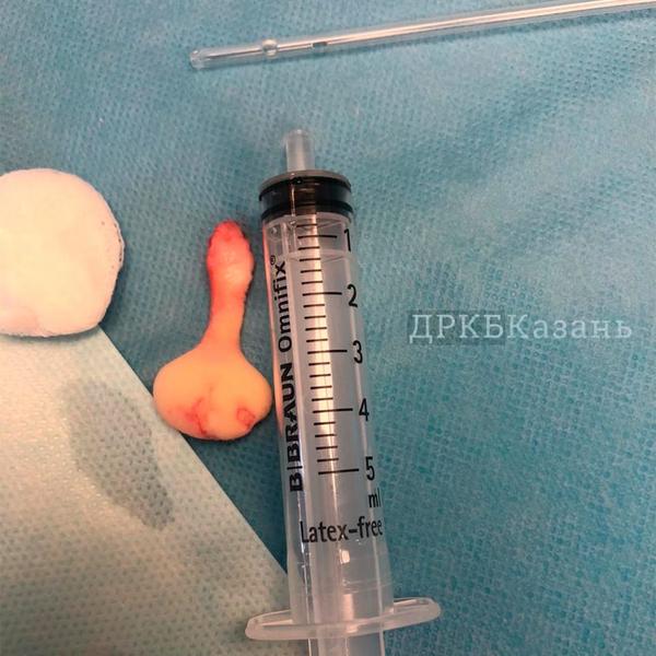 В Казани родился ребенок с двумя языками