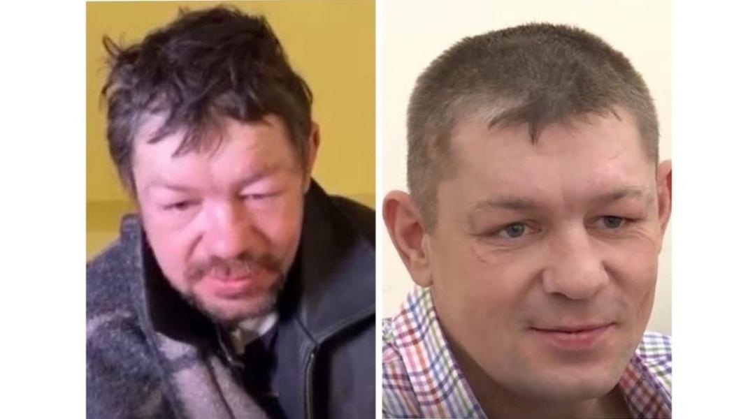 Фото алкоголиков до и после отказа от спиртного мужчин