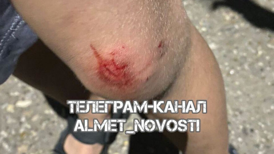 Пострадавшего мальчика отбил от своры его отец.