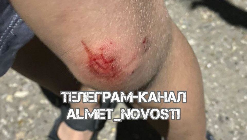 Пострадавшего мальчика отбил от своры его отец.