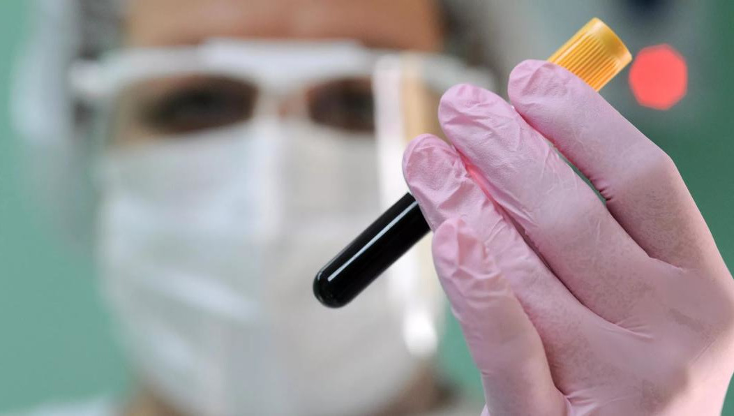 Лаборатория провела уже 17 000 исследований на антитела igg к кори.