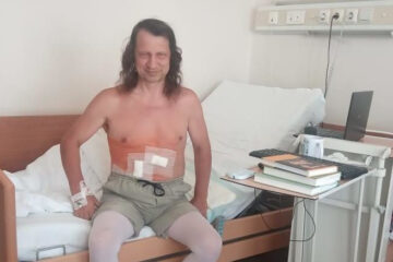 Шмакову провели лапароскопическую операцию на правой почке.
