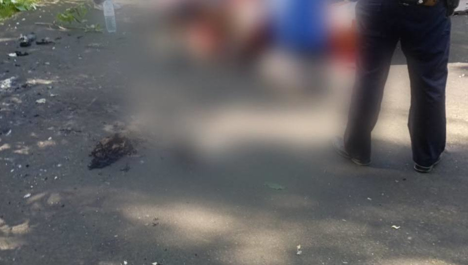 Пострадавший получил 80 процентов ожогов тела