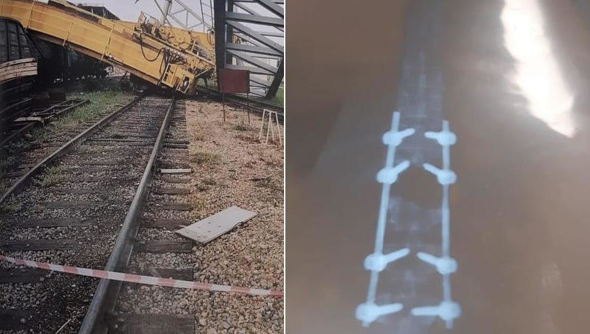 Женщина получила тяжелую травму позвоночника на работе.