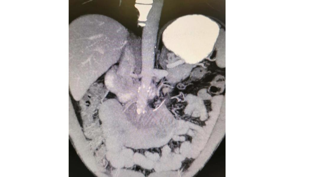 Мужчина не сразу обратился к врачам
