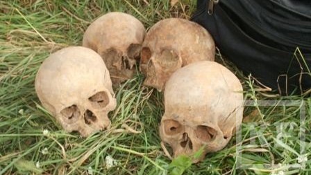 15 человеческих черепов обнаружил на своем земельном участке житель поселка Усады
