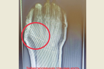 Медики оценили правильные действия супруги пострадавшего