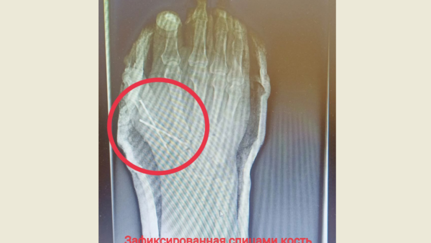 Медики оценили правильные действия супруги пострадавшего