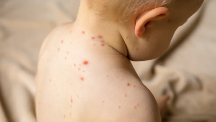 Опрос показал