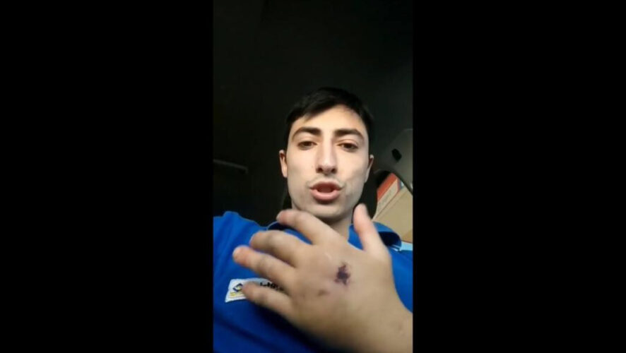 У выходца из Альметьевска начала чернеть рука.