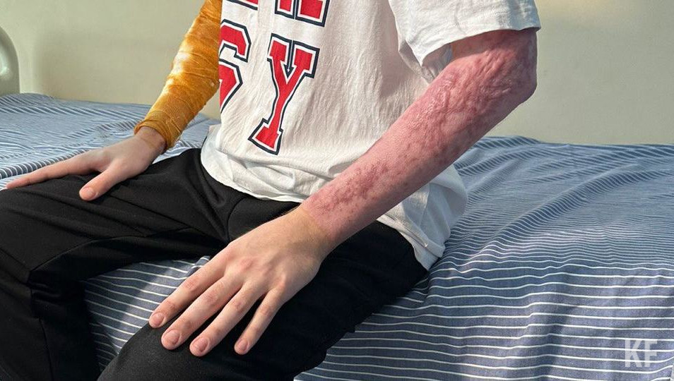 22-летний парень провел два месяца в реанимации