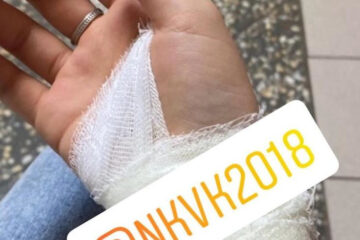 Школьнице придется до декабря делать прививки от бешенства.