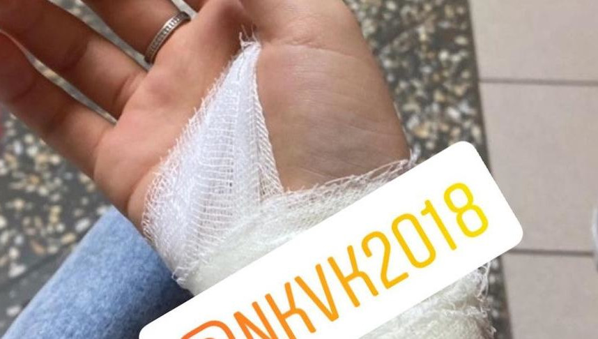 Школьнице придется до декабря делать прививки от бешенства.