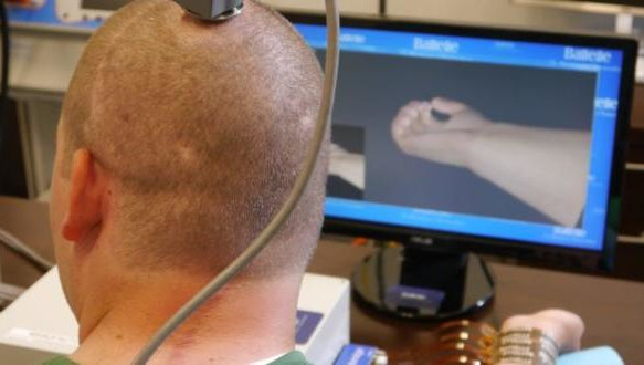 Нейроимпланты могут помочь людям с ограниченными возможностями