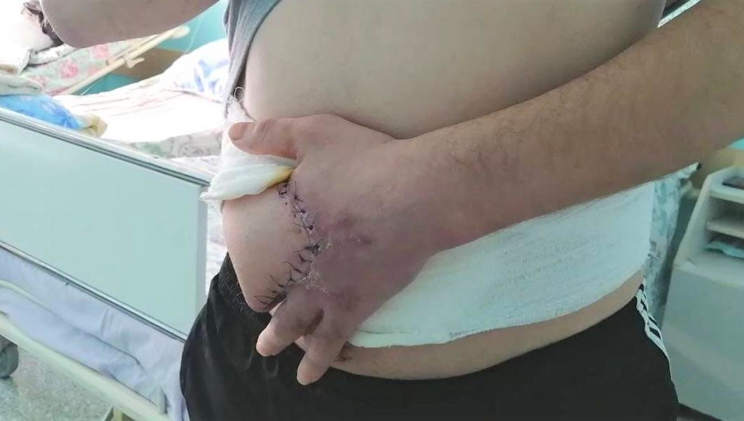 В Югре медики провели медицинское ноу-хау.