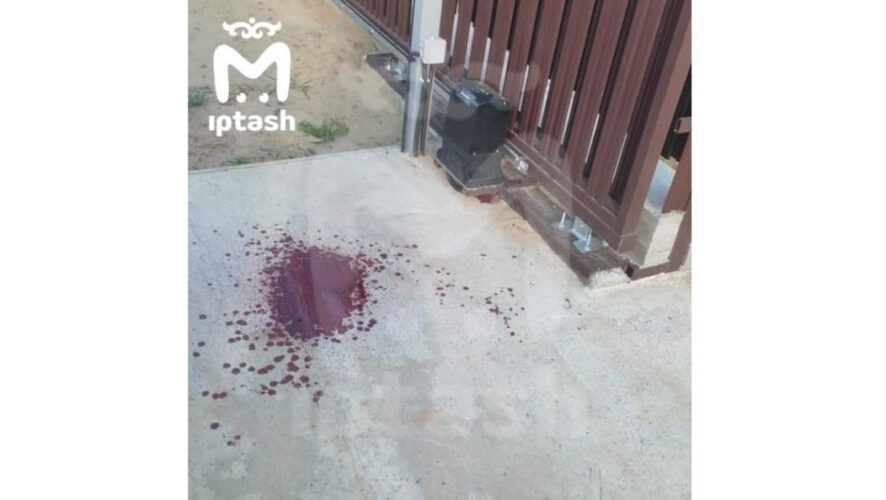 Ребенку&nbsp;может понадобиться операция по восстановлению руки.