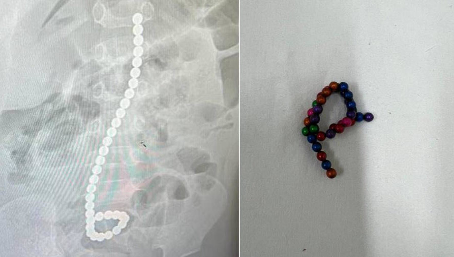 Малыш был доставлен в больницу с высокой температурой