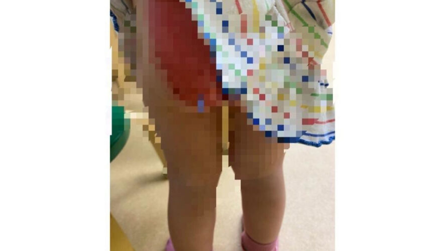 Мама с девочкой отправилась в приемный покой детской больницы