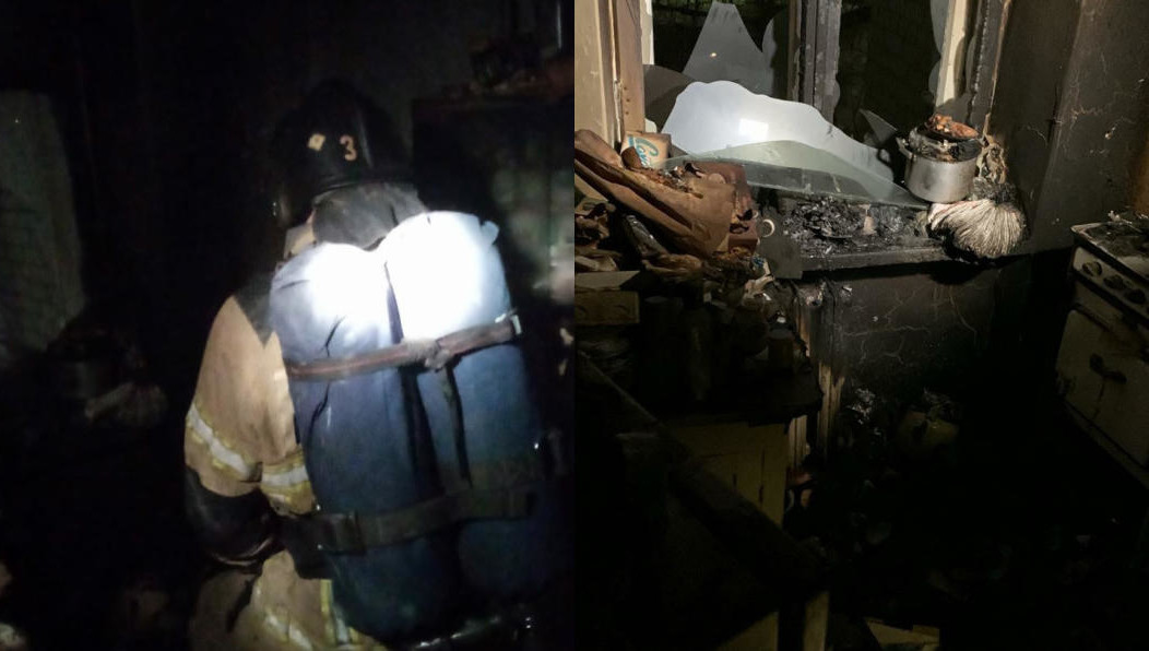 Пострадавшая получила термические ожоги II степени.