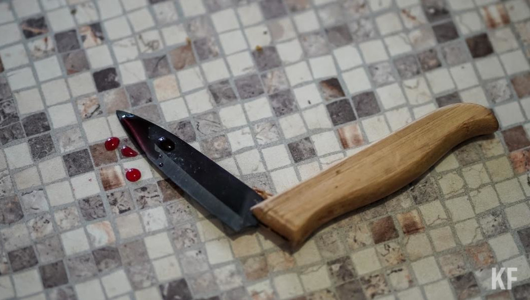 Подозреваемая не помнит причину конфликта